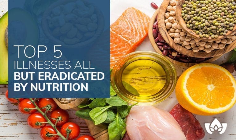 Top 5 Illnesses All But Eradicated By Nutrition | Mindful Healing | Mississauga Naturopathic Doctor