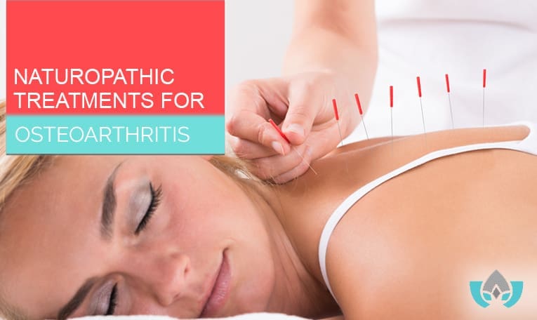 Naturopathic Treatments For Osteoarthritis | Mindful Healing Clinic Dr. Maria Cavallazzi Naturopathic Doctor In Mississauga Streetsville Clinic
