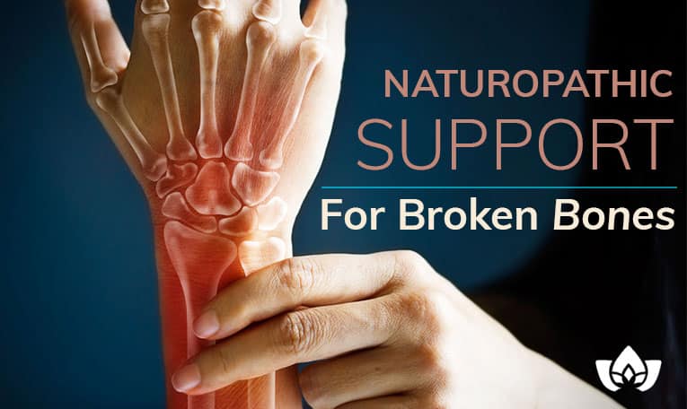 Naturopathic Support For Broken Bones | Mindful Healing | Mississauge Naturopathic Doctor