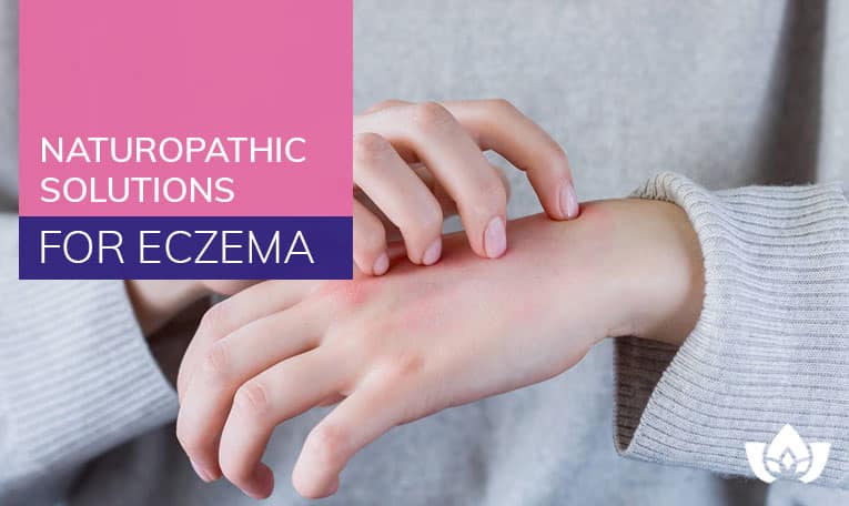 Naturopathic Solutions for Eczema | Mindful Healing | Naturopathic Doctor Mississauga