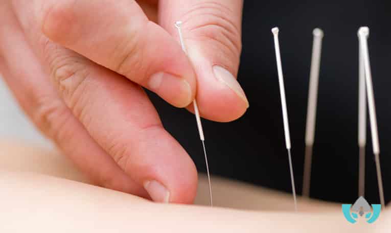 how acupuncture can help with gall bladder issues | Mindful Healing | Naturopathic Doctor Mississauga